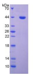 SDS-PAGE (CDK2-1933H).jpg